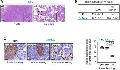 Autophagy Blockage Reduces the Incidence of Pancreatic Ductal Adenocarcinoma in the Context of Mutant Trp53